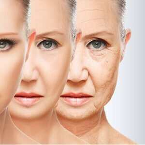 HOW TO PREVENT PREMATURE SKIN AGING